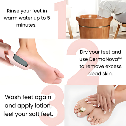Foot Filer V2