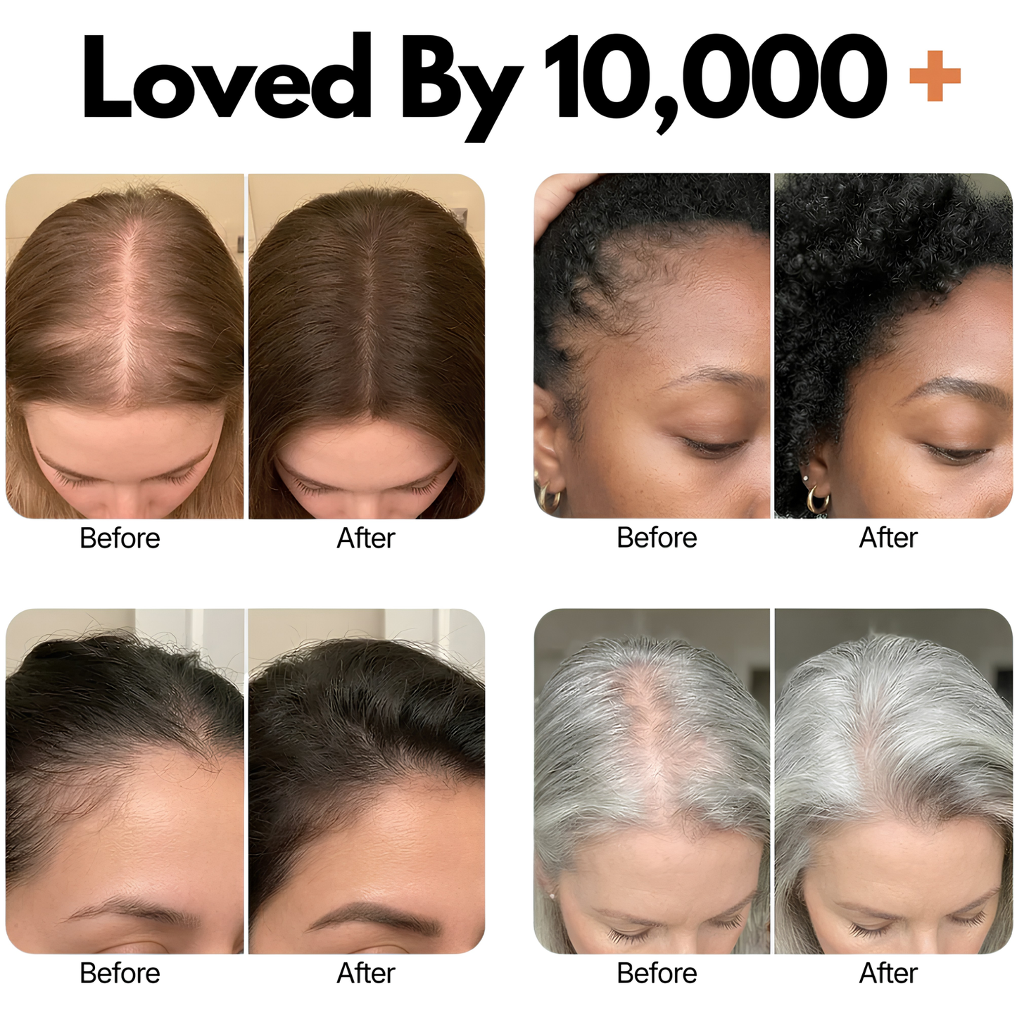 K-Scalp™ - Korean Scalp Renewal Serum