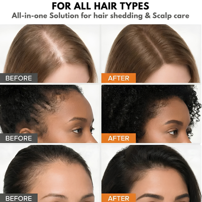 K-Scalp™ - Korean Scalp Renewal Serum